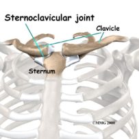 Sternoclavicular Joint