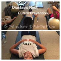 Diastasis Recti in Pregnancy – The Cure is the Prevention. Diastasis-Recti-during-Pregnancy
