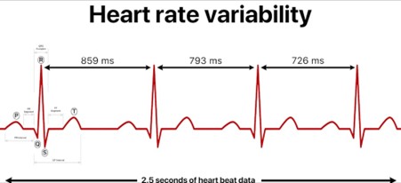 Diagram showing heart rate variability created by YitzhakNat via Wikimedia Commons, CC BY-SA
