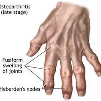 handone